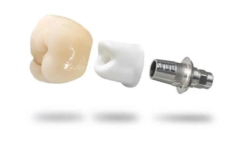 zdjęcie implantu